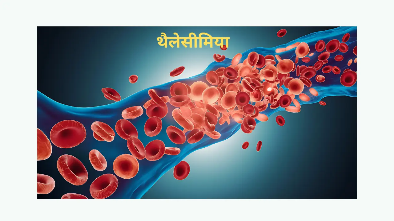 Thalassemia